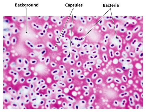 capsule stain microbiology.